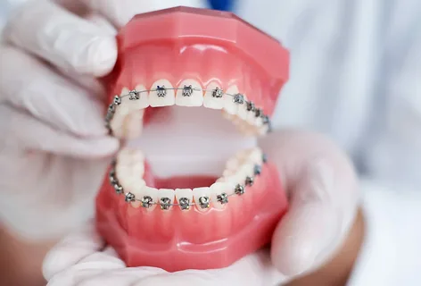 dental braces treatment in Lahore