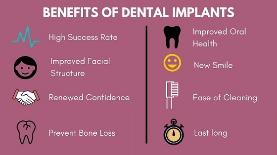 Dental Implants