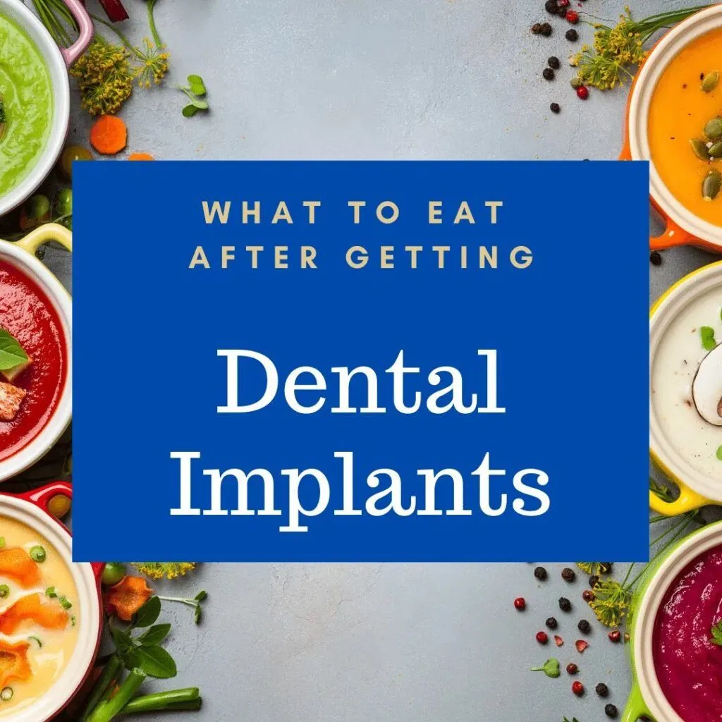 Dental implants