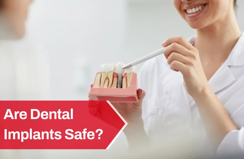 Are Dental Implants Safe? Risks and Benefits Explained