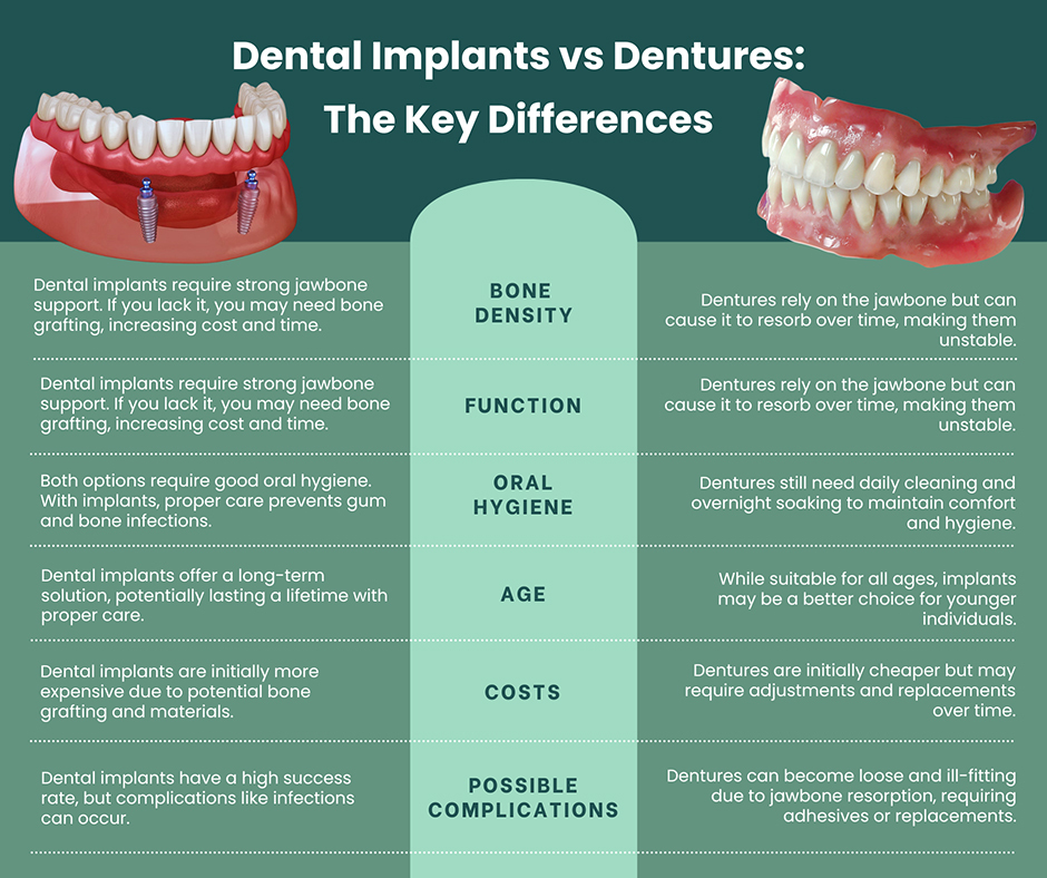 Dental Implants vs dentures